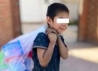 Ataca jauría a menor de diez años en Mixquiahuala