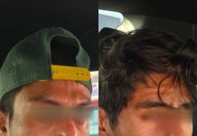 Caen dos por robo violento de auto tras operativo en el Periférico Ecológico