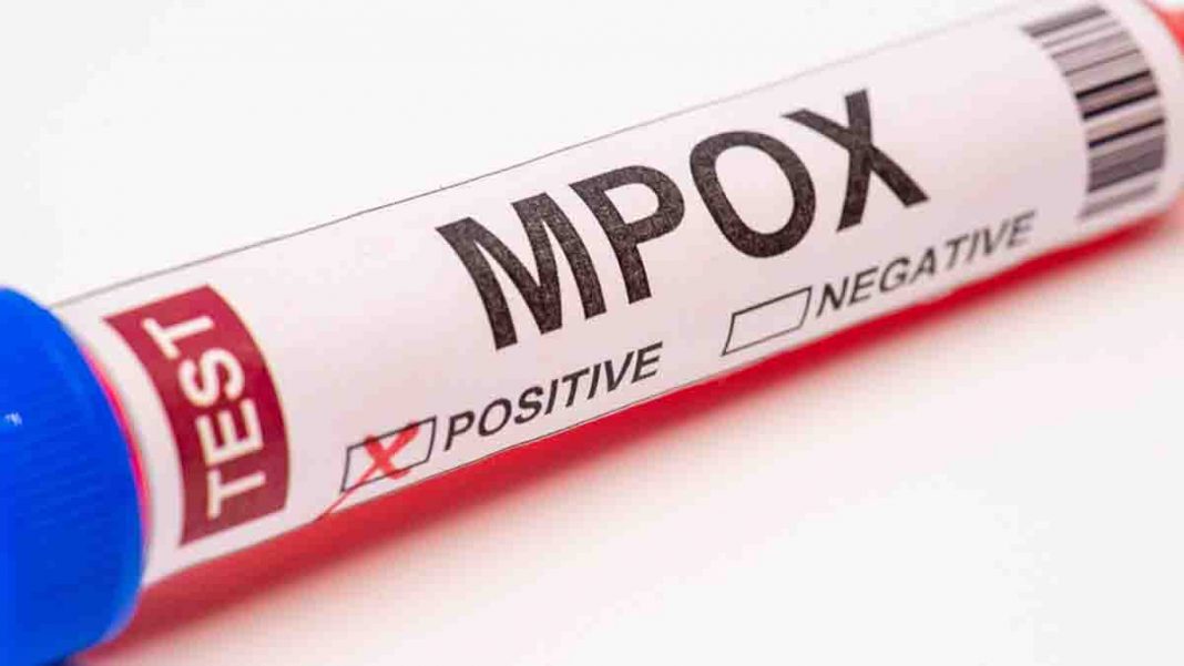mpox-still-211725