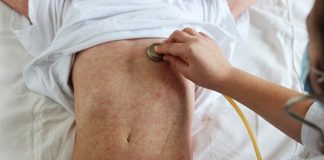 Secretaría de Salud de Chihuahua confirma dos muertes por sarampión