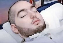 Muere el «príncipe durmiente» tras 20 años en coma
