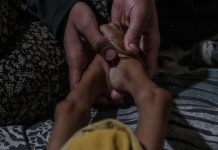 Ya suman más de 250 muertos por desnutrición en Gaza