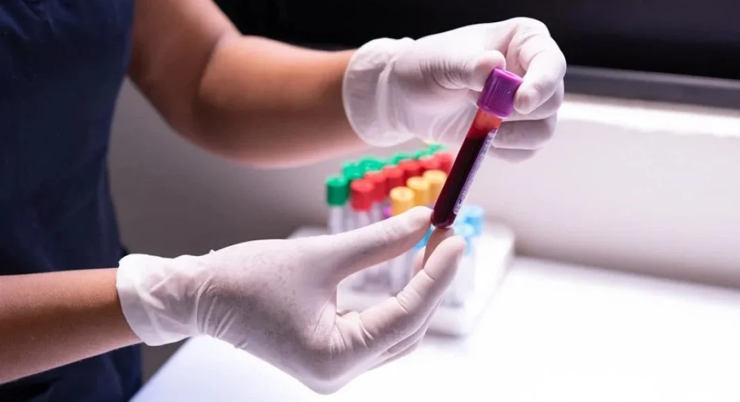 México registra 15 mil 480 nuevos casos de VIH en 2025