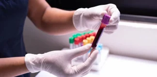 México registra 15 mil 480 nuevos casos de VIH en 2025