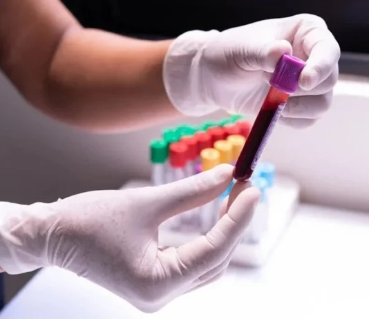 México registra 15 mil 480 nuevos casos de VIH en 2025