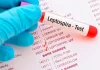 Perú en alerta por brote de leptospirosis; van cinco muertos